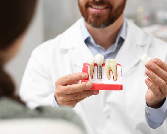 a dentist holding a model of a dental implant