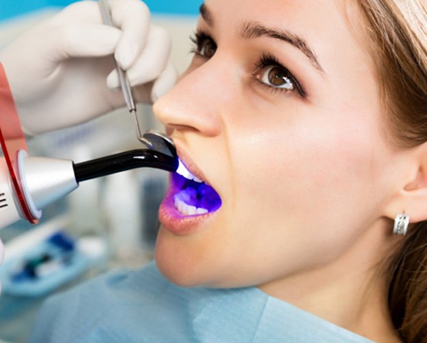 woman having her teeth bonded