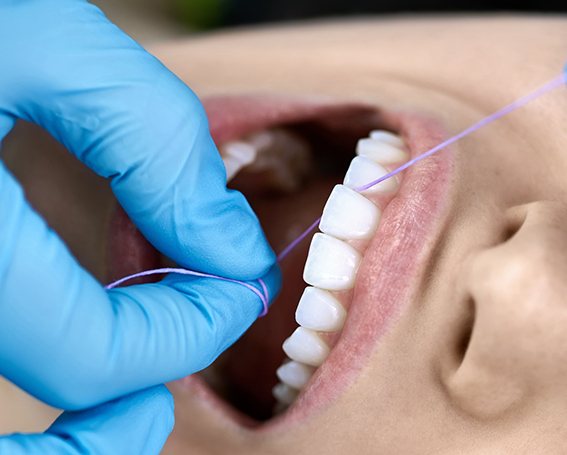 flossing patient’s teeth during dental exam in Leesburg 