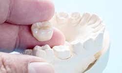 Close up of dental crown and dental mold