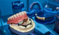 implant dentures lying on a table