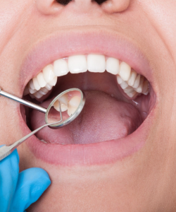 Fingers holding dental instruments to reflect a cavity in woman’s mouth