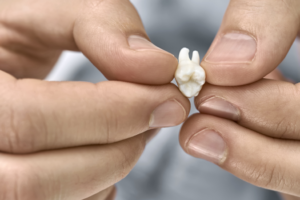 a patient holding their knocked-out tooth