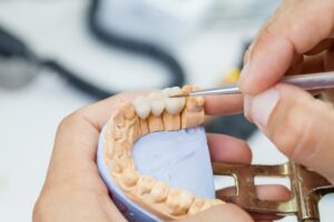 Dental bridge shown on mouth mold.